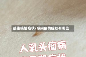 感染疫情症状/感染疫情症状有哪些